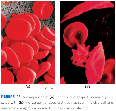 Sickle Cell Mutation Part 1